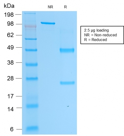 Data from SDS-PAGE analysis of Anti-PSAP antibody (Clone rACPP/1338). Reducing lane (R) shows heavy and light chain fragments. NR lane shows intact antibody with expected MW of approximately 150 kDa. The data are consistent with a high purity, intact mAb.